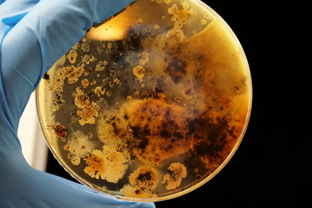 Bacterial Warning in the World of Meat: Revisiting Dangerous Products!