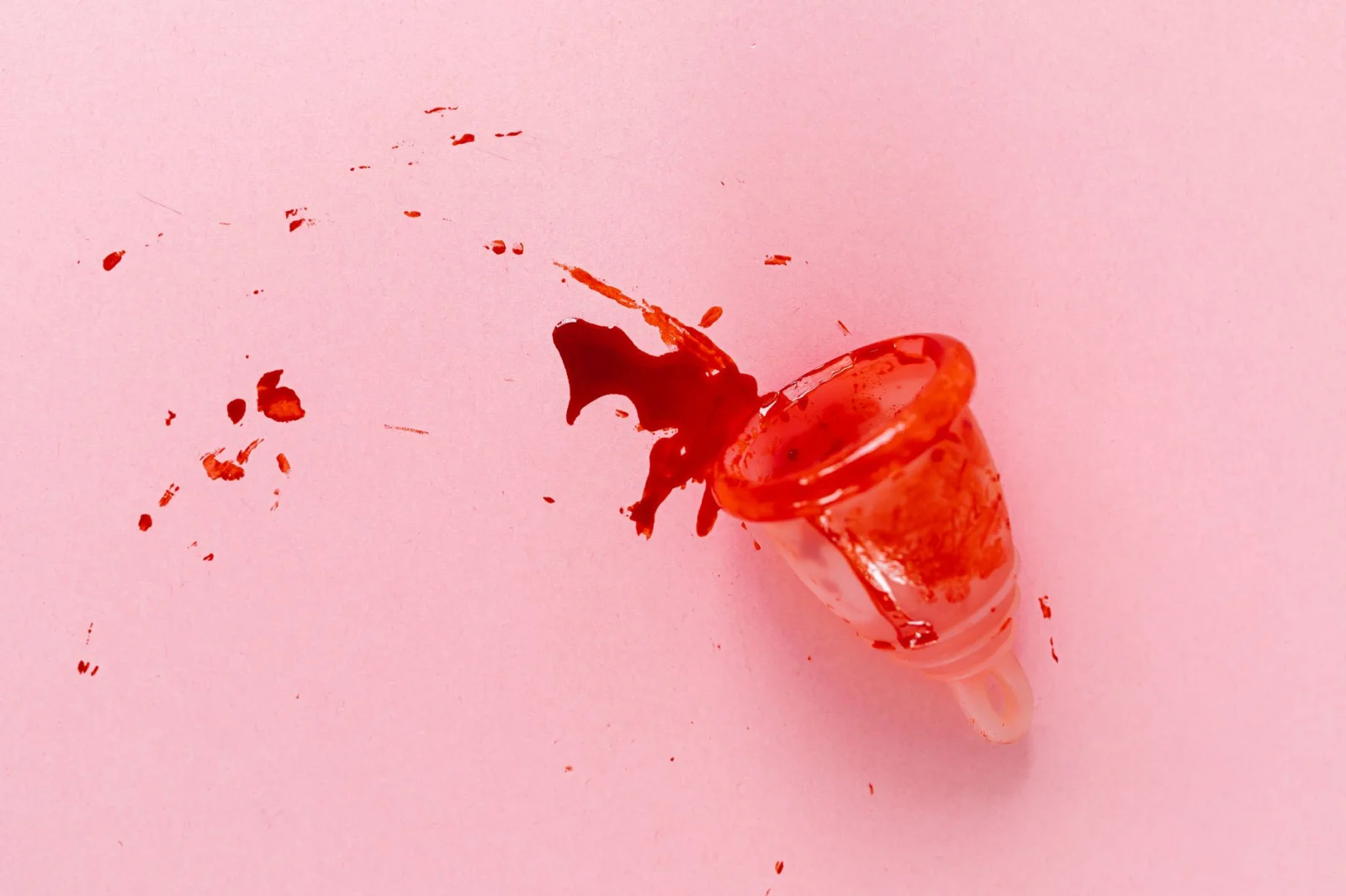 Blood in Urine: A Serious Danger or Just a Symptom?