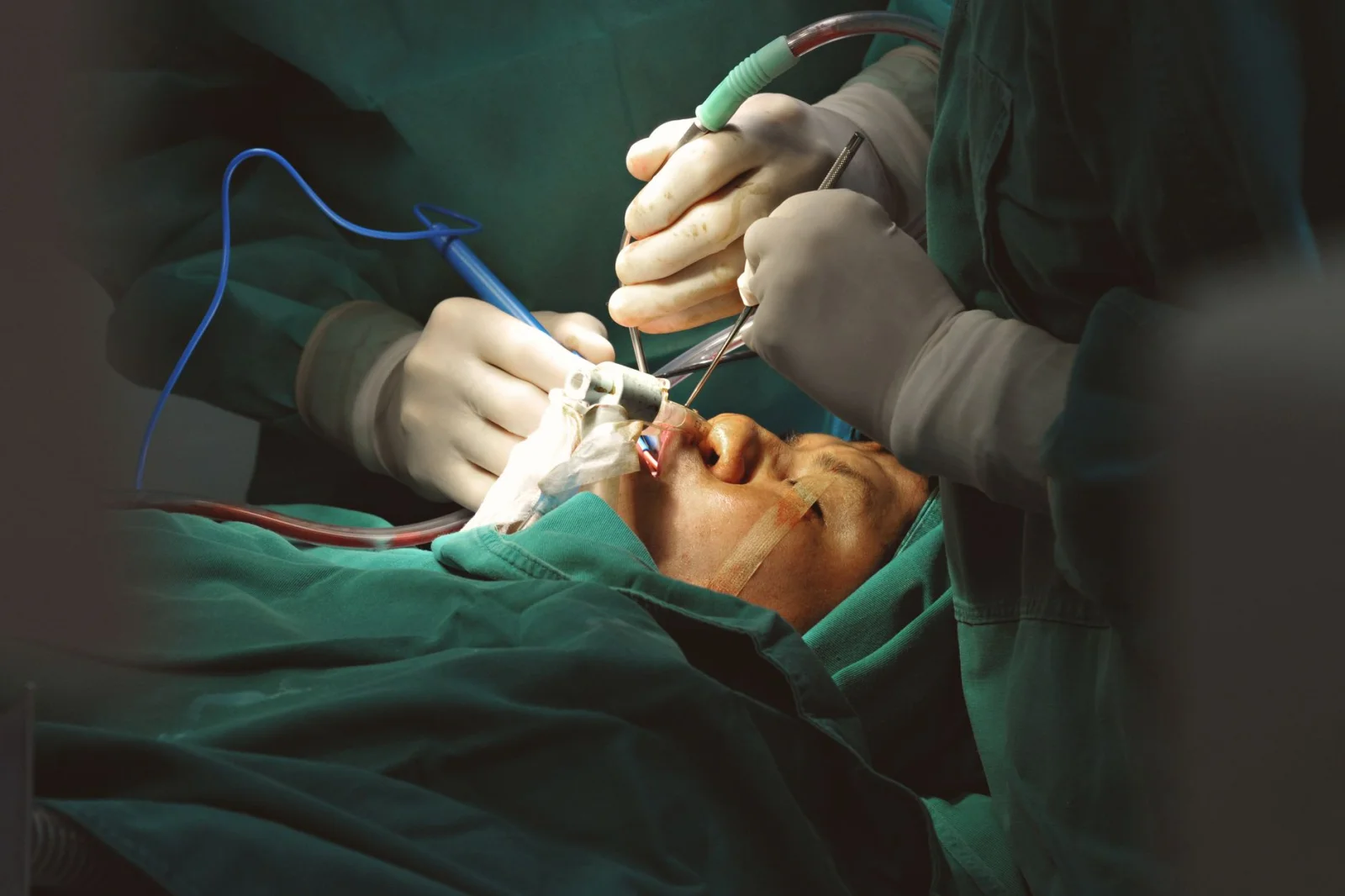 Controversial Surgeries for Male Beauty: The Looksmaxxing Trend